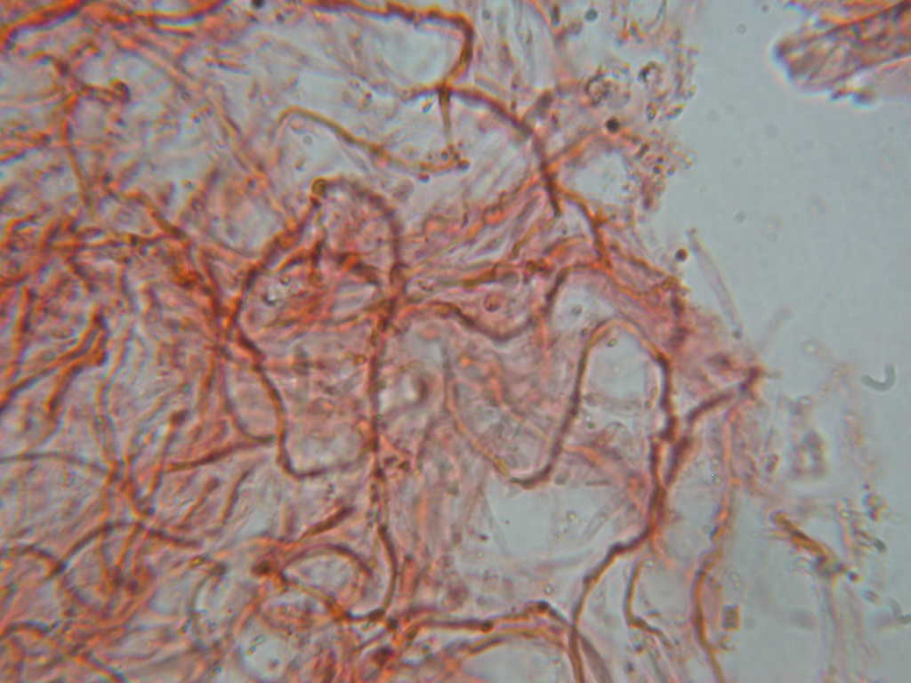 Da determinare...  (Dacryobolus karstenii)